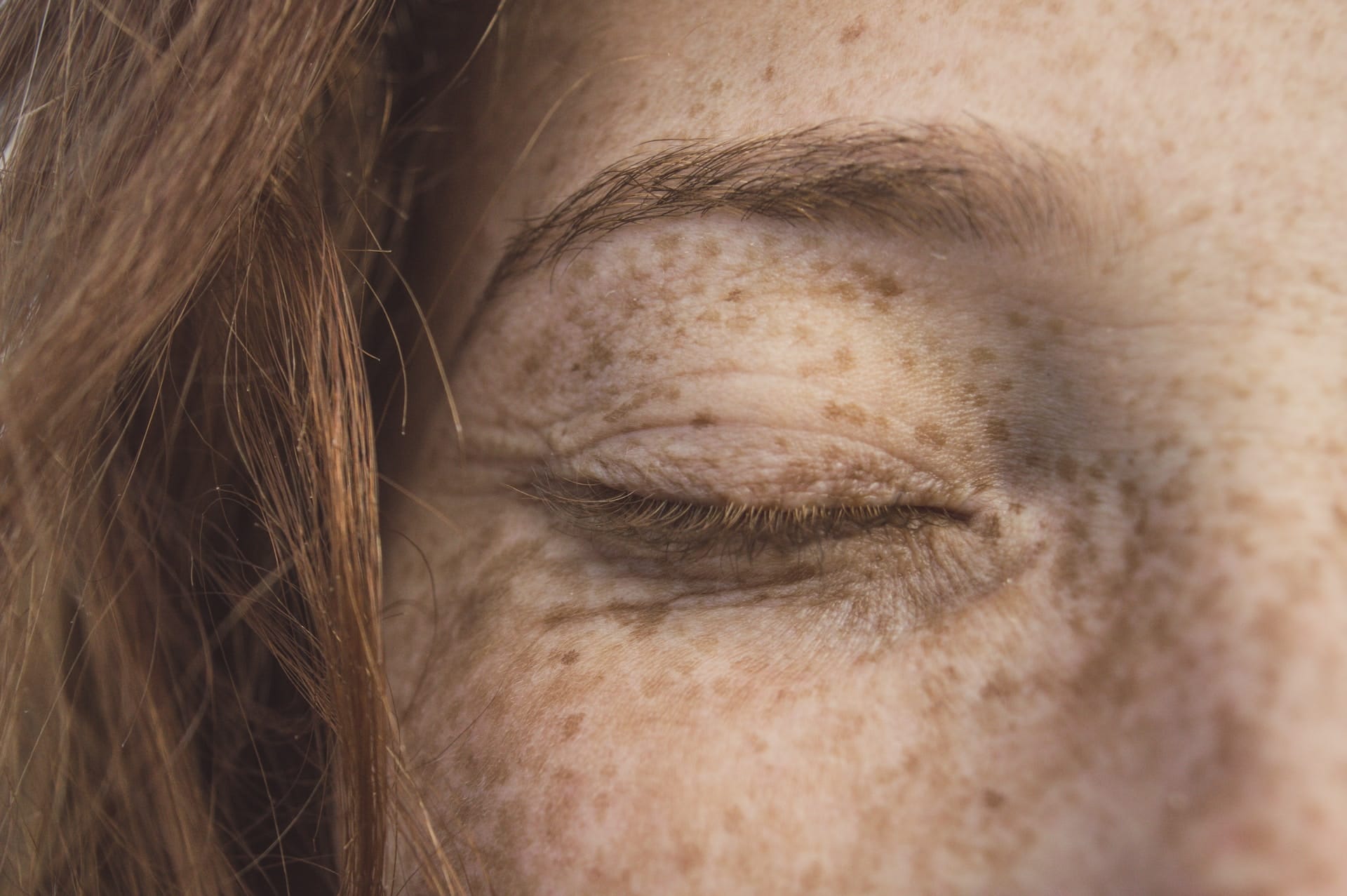 Beautiful woman with glowing Heidelberg cosmetic treatment skin